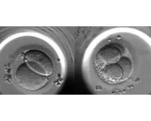 北京捐卵机构私立,北京朝阳区第三代试管婴儿的费用？价格能医保吗？