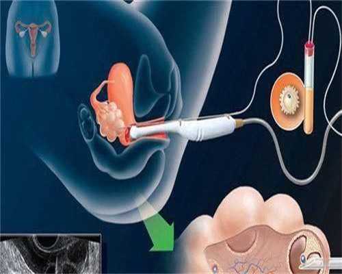试管包男孩是真的吗,染色体异常能做三代试管生小孩吗?染色体异常做不了三