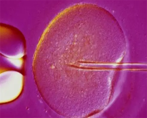 摆脱腰痛困扰，预防妇科病不再是难题！